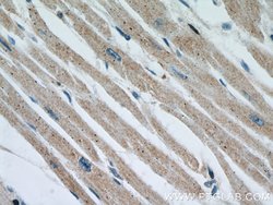 OTUD7B Rabbit anti-Human, Mouse, Rat, Polyclonal, Proteintech 150 &mu;L;