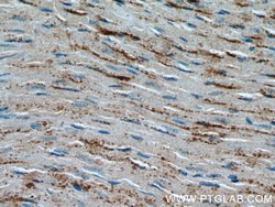 OTUD7B Rabbit anti-Human, Mouse, Rat, Polyclonal, Proteintech 150 &mu;L;