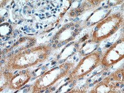 OTUD7B Rabbit anti-Human, Mouse, Rat, Polyclonal, Proteintech 150 &mu;L;