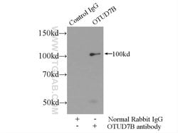 OTUD7B Rabbit anti-Human, Mouse, Rat, Polyclonal, Proteintech 150 &mu;L;