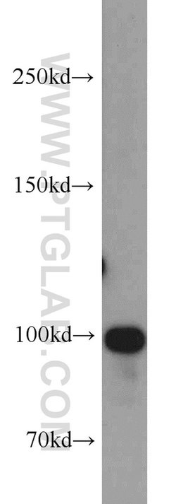 OTUD7B Rabbit anti-Human, Mouse, Rat, Polyclonal, Proteintech 150 &mu;L;