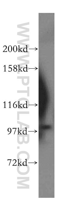 OTUD7B Rabbit anti-Human, Mouse, Rat, Polyclonal, Proteintech 150 &mu;L;