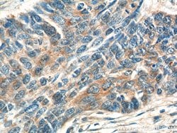 ATAD3 Rabbit anti-Human, Mouse, Rat, Polyclonal, Proteintech 150 &mu;L;