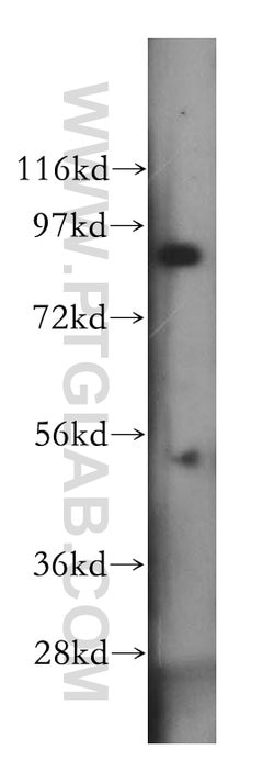 BCL2L13 Rabbit anti-Human, Mouse, Rat, Polyclonal, Proteintech 150 &mu;L;