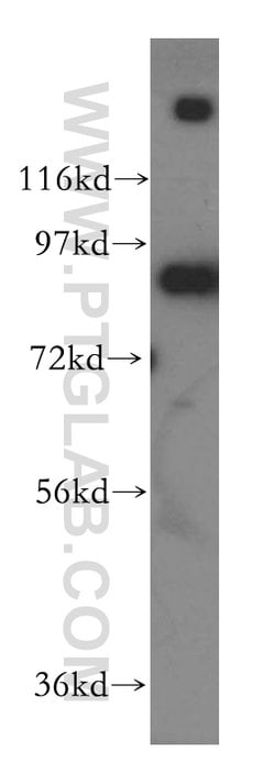BCL2L13 Rabbit anti-Human, Mouse, Rat, Polyclonal, Proteintech 150 &mu;L;