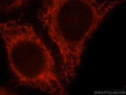 BCL2L13 Rabbit anti-Human, Mouse, Rat, Polyclonal, Proteintech 150 &mu;L;