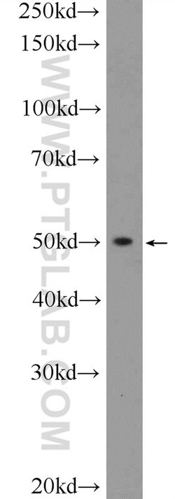 BCL2L13 Rabbit anti-Human, Mouse, Rat, Polyclonal, Proteintech 150 &mu;L;
