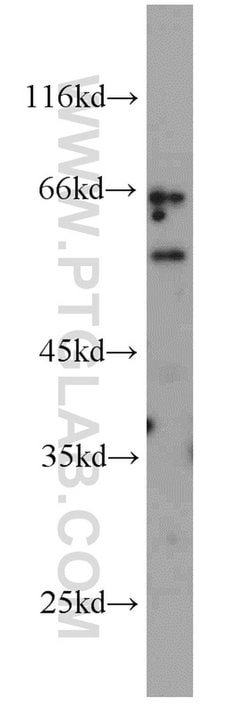 LAG-3 Rabbit anti-Human, Mouse, Rat, Polyclonal, Proteintech:Antibodies:Primary