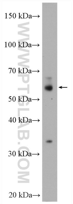 LAG-3 Rabbit anti-Human, Mouse, Rat, Polyclonal, Proteintech:Antibodies:Primary