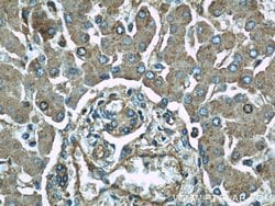ME1 Rabbit anti-Human, Mouse, Rat, Polyclonal, Proteintech:Antibodies:Primary