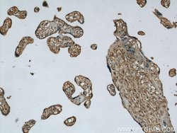 ME1 Rabbit anti-Human, Mouse, Rat, Polyclonal, Proteintech:Antibodies:Primary