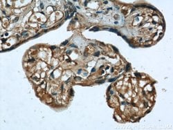 ME1 Rabbit anti-Human, Mouse, Rat, Polyclonal, Proteintech:Antibodies:Primary