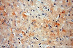 ME1 Rabbit anti-Human, Mouse, Rat, Polyclonal, Proteintech:Antibodies:Primary