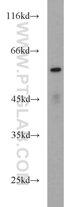 ME1 Rabbit anti-Human, Mouse, Rat, Polyclonal, Proteintech:Antibodies:Primary