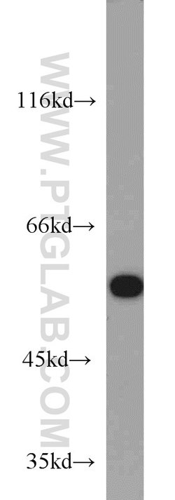 ME1 Rabbit anti-Human, Mouse, Rat, Polyclonal, Proteintech:Antibodies:Primary
