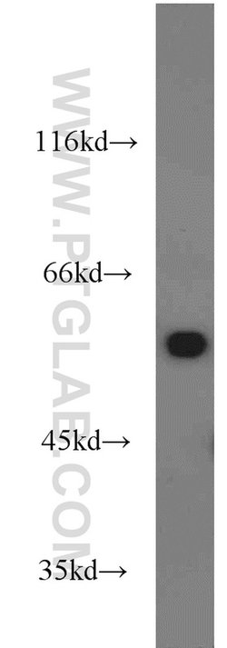 ME1 Rabbit anti-Human, Mouse, Rat, Polyclonal, Proteintech:Antibodies:Primary