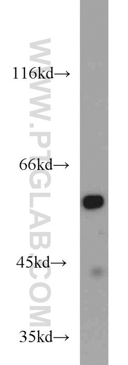 ME1 Rabbit anti-Human, Mouse, Rat, Polyclonal, Proteintech:Antibodies:Primary