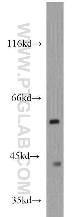 ME1 Rabbit anti-Human, Mouse, Rat, Polyclonal, Proteintech:Antibodies:Primary