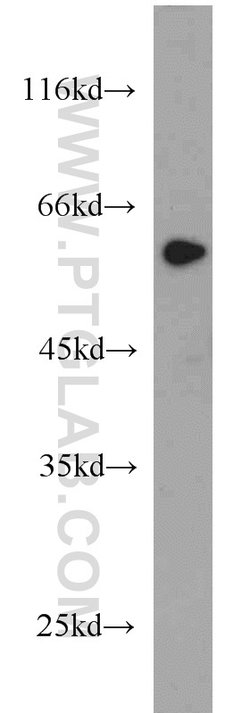 ME1 Rabbit anti-Human, Mouse, Rat, Polyclonal, Proteintech:Antibodies:Primary