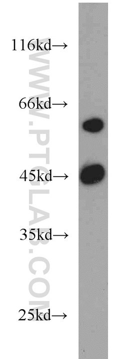 ME1 Rabbit anti-Human, Mouse, Rat, Polyclonal, Proteintech:Antibodies:Primary