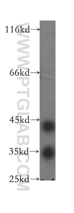 TMLHE Rabbit anti-Human, Mouse, Rat, Polyclonal, Proteintech 150 &mu;L;