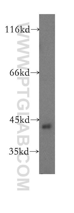 TMLHE Rabbit anti-Human, Mouse, Rat, Polyclonal, Proteintech 150 &mu;L;