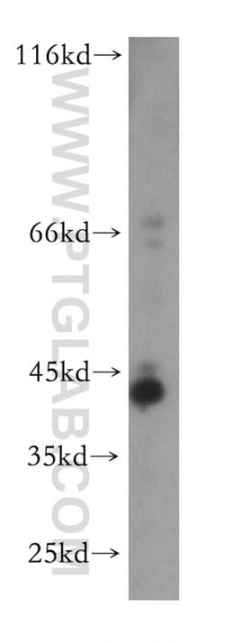 TMLHE Rabbit anti-Human, Mouse, Rat, Polyclonal, Proteintech 150 &mu;L;