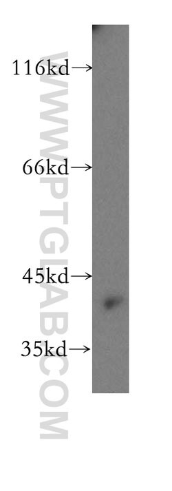 HOMER3 Rabbit anti-Human, Mouse, Rat, Polyclonal, Proteintech:Antibodies:Primary