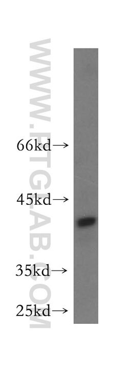 HOMER3 Rabbit anti-Human, Mouse, Rat, Polyclonal, Proteintech:Antibodies:Primary