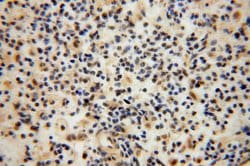 COPS7A Rabbit anti-Human, Mouse, Rat, Polyclonal, Proteintech:Antibodies:Primary