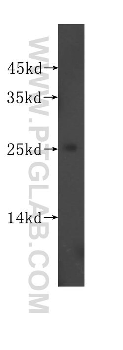 RPL32 Rabbit anti-Human, Mouse, Rat, Polyclonal, Proteintech 150 &mu;L;