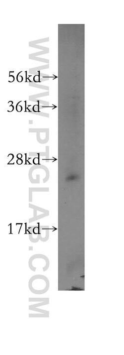 RPL32 Rabbit anti-Human, Mouse, Rat, Polyclonal, Proteintech 150 &mu;L;