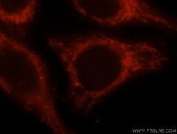 OCIAD1 Rabbit anti-Human, Mouse, Rat, Polyclonal, Proteintech 150 &mu;L;