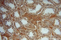 OCIAD1 Rabbit anti-Human, Mouse, Rat, Polyclonal, Proteintech 150 &mu;L;