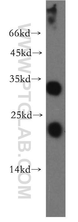 OCIAD1 Rabbit anti-Human, Mouse, Rat, Polyclonal, Proteintech 150 &mu;L;