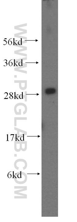 OCIAD1 Rabbit anti-Human, Mouse, Rat, Polyclonal, Proteintech 150 &mu;L;
