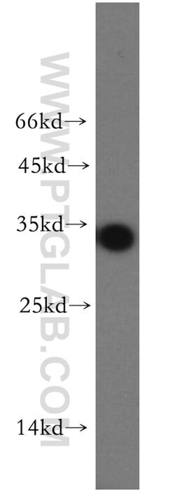 OCIAD1 Rabbit anti-Human, Mouse, Rat, Polyclonal, Proteintech 150 &mu;L;