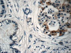 EPLIN Rabbit anti-Human, Mouse, Rat, Polyclonal, Proteintech 150 &mu;L;