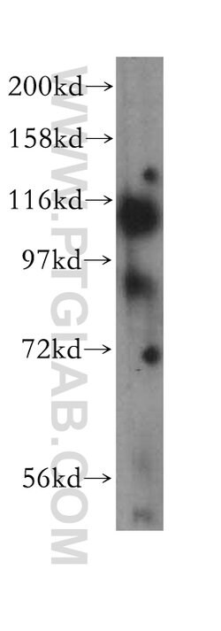 EPLIN Rabbit anti-Human, Mouse, Rat, Polyclonal, Proteintech 150 &mu;L;
