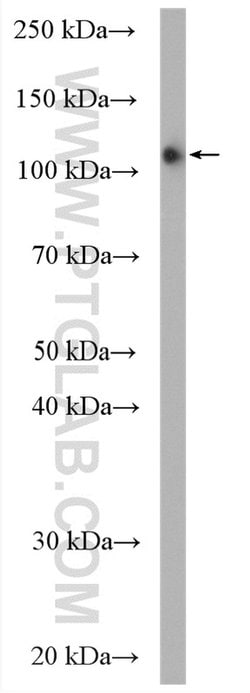 EPLIN Rabbit anti-Human, Mouse, Rat, Polyclonal, Proteintech 150 &mu;L;
