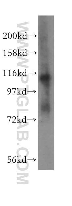 EPLIN Rabbit anti-Human, Mouse, Rat, Polyclonal, Proteintech 150 &mu;L;