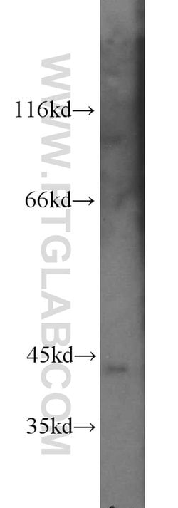 PRKX Rabbit anti-Human, Mouse, Rat, Polyclonal, Proteintech:Antibodies:Primary