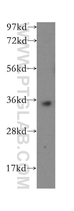 PRPS1L1 Rabbit anti-Human, Mouse, Rat, Polyclonal, Proteintech 150 &mu;L;