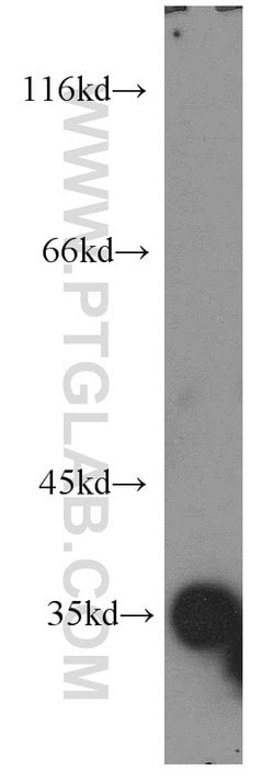 PRPS1L1 Rabbit anti-Human, Mouse, Rat, Polyclonal, Proteintech 150 &mu;L;