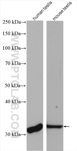 PRPS1L1 Rabbit anti-Human, Mouse, Rat, Polyclonal, Proteintech 150 &mu;L;