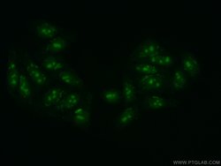 DDX52 Rabbit anti-Human, Mouse, Rat, Polyclonal, Proteintech 150 &mu;L;