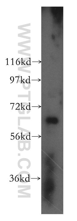 DDX52 Rabbit anti-Human, Mouse, Rat, Polyclonal, Proteintech 150 &mu;L;