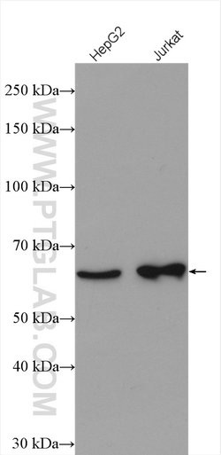 DDX52 Rabbit anti-Human, Mouse, Rat, Polyclonal, Proteintech 150 &mu;L;