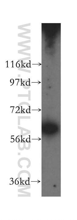DDX52 Rabbit anti-Human, Mouse, Rat, Polyclonal, Proteintech 150 &mu;L;