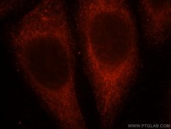 UGT2B7 Rabbit anti-Human, Mouse, Polyclonal, Proteintech:Antibodies:Primary